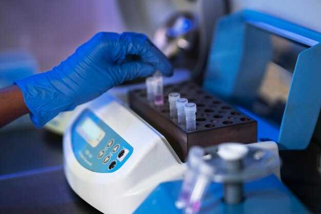 Ezetimibe chiral hplc