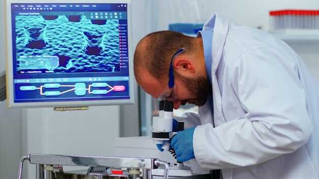 Ezetimibe hplc method