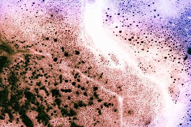 Ezetimibe solid dispersions