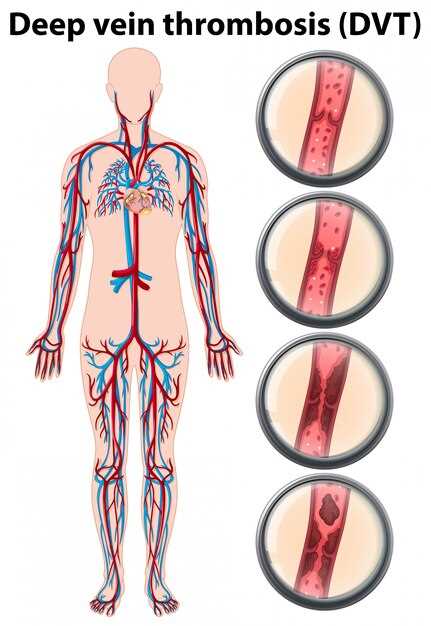 Ezetimibe thrombocytopenia