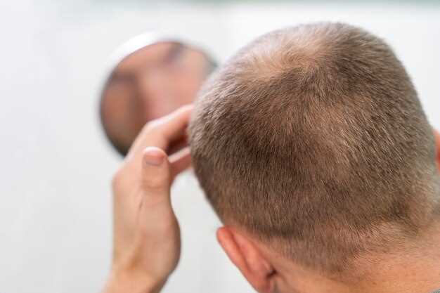 Simvastatin and ezetimibe alopecia